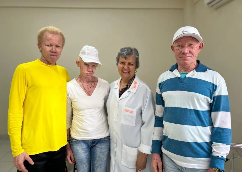 ICB celebra Dia do Albinismo com atendimento especializado e aula de forró para pacientes